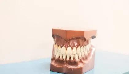 Tannerstatning – disse alternativene har du