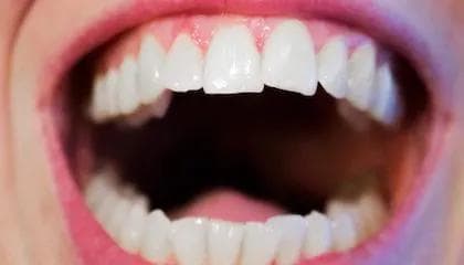 The Wand – smertefri bedøvelse hos tannlegen