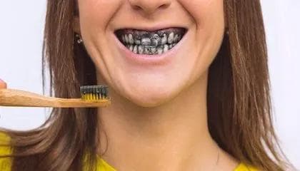 Tannkrem for hvitere tenner – fungerer det?