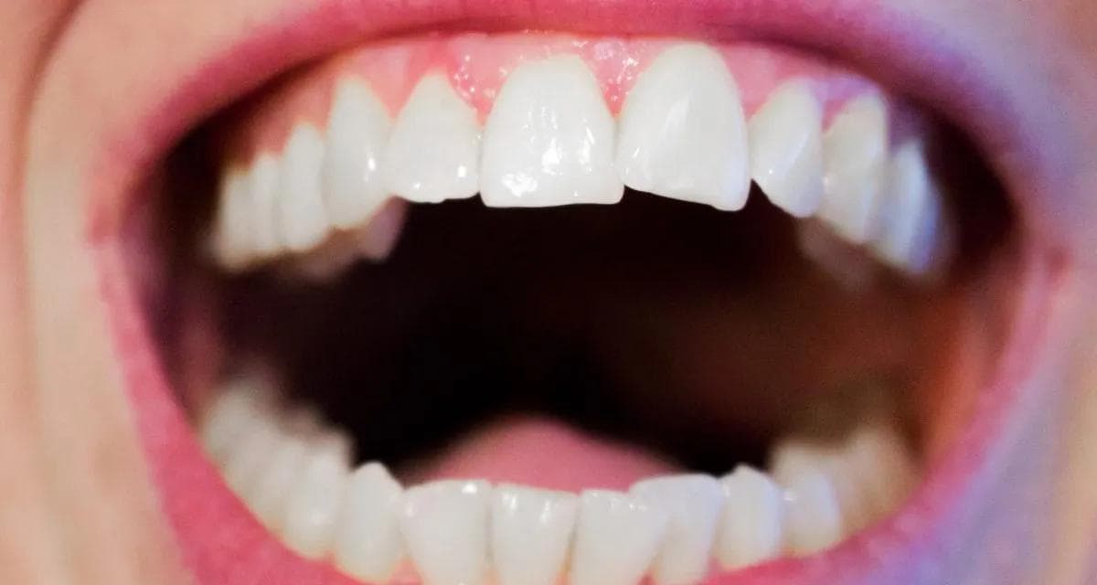 Gi smilet ditt et løft med estetiske tannbehandlinger