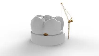 Derfor bruker vi ikke lengre amalgam