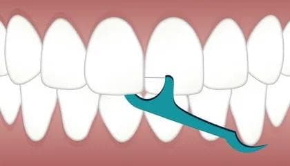 Derfor skal du bruke tanntråd