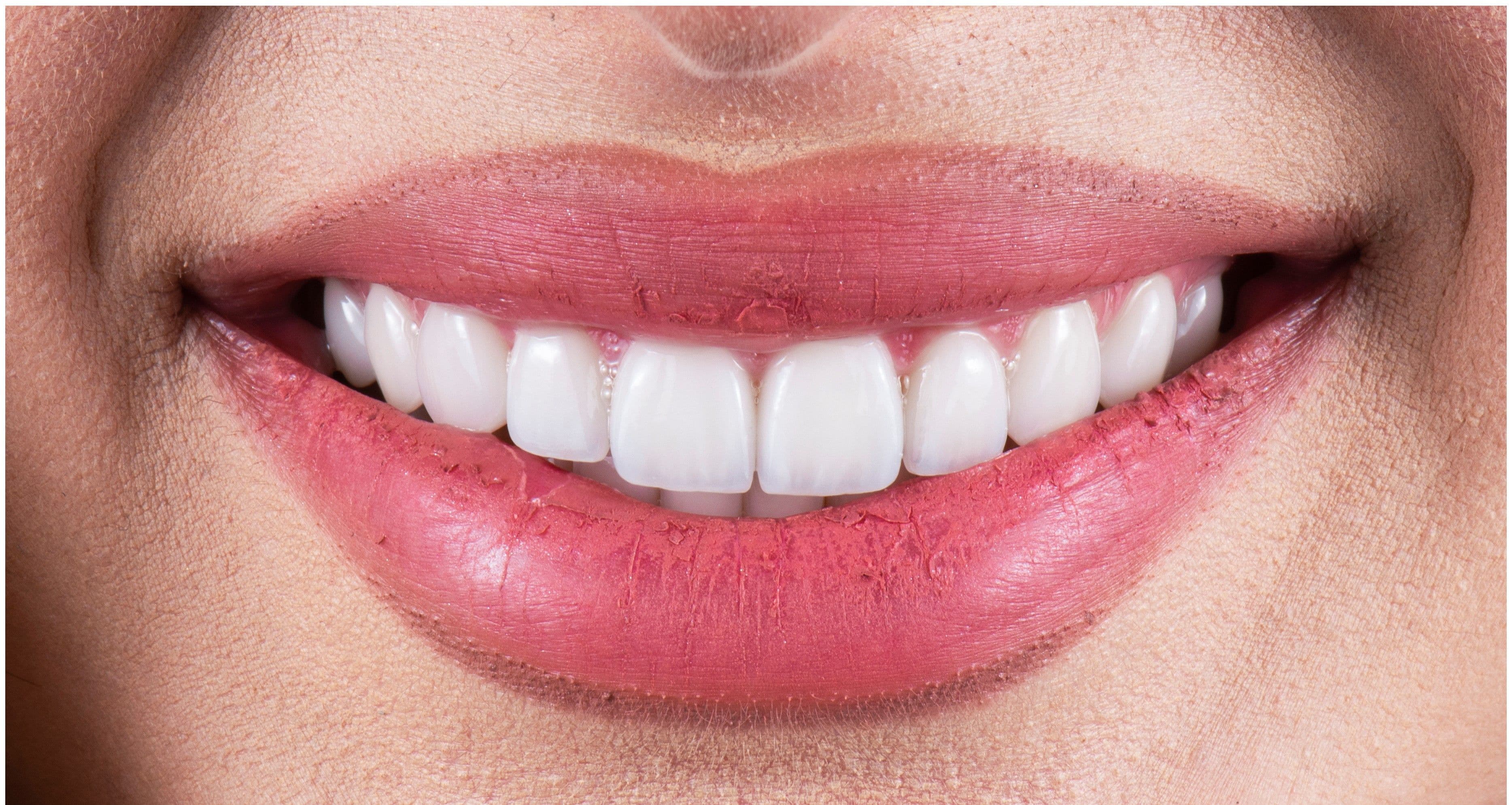 Tannregulering – se hvilke typer tannregulering vi tilbyr