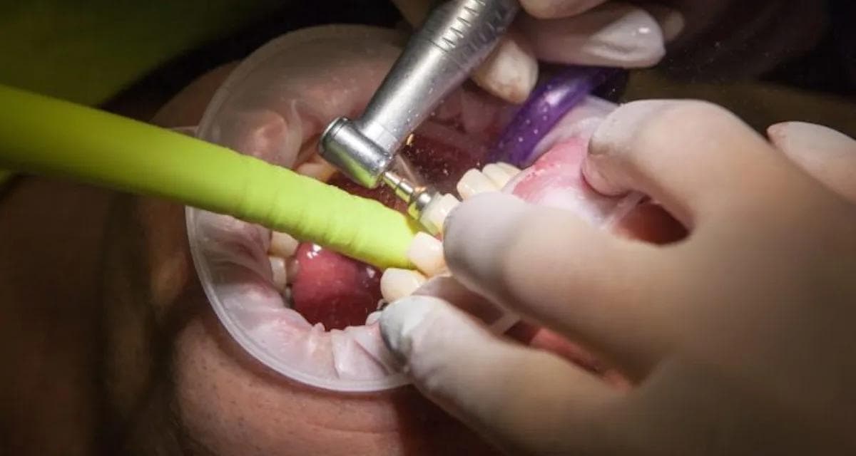 Tannlegebehandling med bor