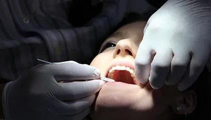 Sprukket jeksel, hva må jeg gjøre?