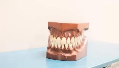 Hva er en tannkrone og når trenger man en?