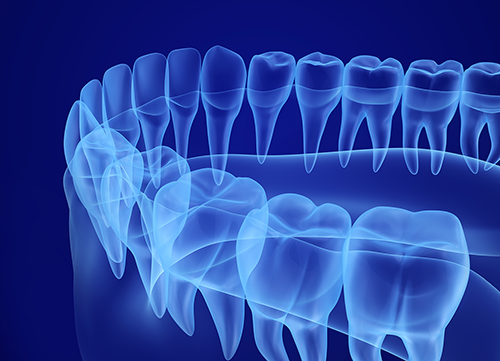 Grafikk av tannregulering blått